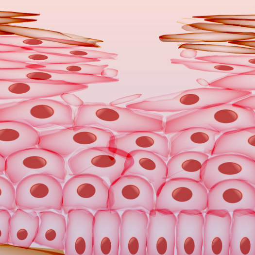 skin-repair-hbot skin-repair-hbot